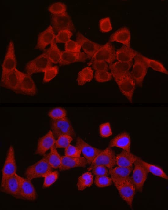 Immunocytochemistry/ Immunofluorescence SEC61A Antibody - Azide and BSA Free