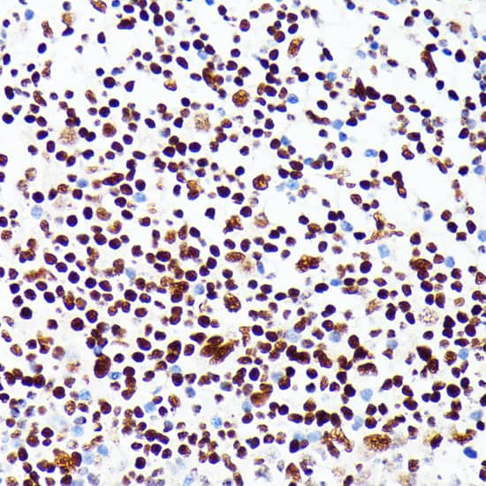 Immunohistochemistry: PML Protein Antibody - BSA Free [PML Protein] - Immunohistochemistry analysis of paraffin-embedded human appendix using PML Protein Rabbit pAb  at dilution of 1:100 (40x lens).Perform microwave antigen retrieval with 10 mM PBS buffer pH 7.2 before commencing with IHC staining protocol.