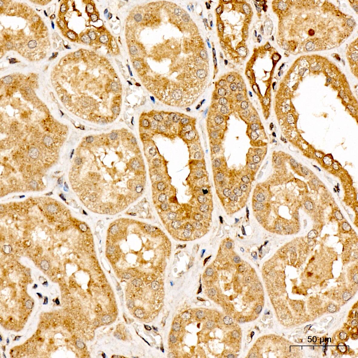 Immunohistochemistry: UPF2 Antibody - BSA Free [NBP2-94519] - Immunohistochemistry analysis of UPF2 in paraffin-embedded Human kidney tissue using UPF2 Rabbit pAb (A7091) at a dilution of  1:200 (40x lens). High pressure antigen retrieval was performed with 0.01 M citrate buffer (pH 6.0) prior to IHC staining.