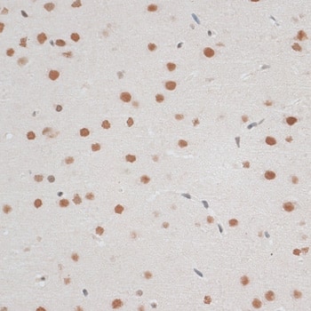 Immunohistochemistry: ZNF148 Antibody - BSA Free [ZNF148] - Immunohistochemistry analysis of paraffin-embedded Rat brain using ZNF148 Rabbit pAb  at dilution of 1:100 (40x lens).Perform microwave antigen retrieval with 10 mM PBS buffer pH 7.2 before commencing with IHC staining protocol.