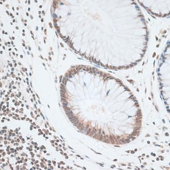 Immunohistochemistry: ZNF148 Antibody - BSA Free [ZNF148] - Immunohistochemistry analysis of paraffin-embedded Human colon using ZNF148 Rabbit pAb  at dilution of 1:100 (40x lens).Perform microwave antigen retrieval with 10 mM PBS buffer pH 7.2 before commencing with IHC staining protocol.