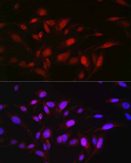 Immunocytochemistry/ Immunofluorescence: Zeta Opioid Receptor Antibody - Azide and BSA Free [Zeta Opioid Receptor] - Immunofluorescence analysis of U2OS cells using Zeta Opioid Receptor Rabbit pAb  at dilution of 1:50 (40x lens). Secondary antibody: Cy3-conjugated Goat anti-Rabbit IgG (H+L)  at 1:500 dilution. Blue: DAPI for nuclear staining.