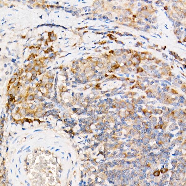 Immunohistochemistry: Testin Antibody - Azide and BSA Free [Testin] - Immunohistochemistry analysis of paraffin-embedded Rat spleen using Testin Rabbit pAb  at dilution of 1:200 (40x lens). Perform high pressure antigen retrieval with 10 mM citrate buffer pH 6.0 before commencing with IHC staining protocol.