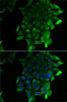 Immunocytochemistry/ Immunofluorescence Soluble Liver/Pancreas Antigen Antibody - BSA Free