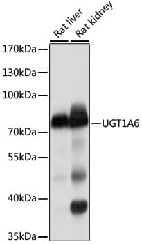 Western Blot: UGT1A6 Antibody - BSA Free [NBP2-94532] - Western blot analysis of extracts of HepG2 cells, using UGT1A6 antibody (A10033) at 1:1000 dilution.Secondary antibody: HRP Goat Anti-Rabbit IgG (H+L) (AS014) at 1:10000 dilution.Lysates/proteins: 25μg per lane.Blocking buffer: 3% nonfat dry milk in TBST.Detection: ECL Basic Kit (RM00020).Exposure time: 10s.