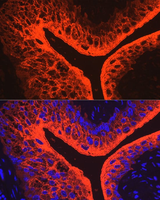 Immunocytochemistry/ Immunofluorescence: Uroplakin III Antibody - BSA Free [NBP2-94533] - Immunofluorescence analysis of mouse bladder using Uroplakin III Rabbit pAb (A10034) at dilution of 1:100 (40x lens). Blue: DAPI for nuclear staining.