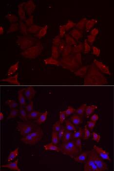 Immunocytochemistry/ Immunofluorescence: Pannexin-1 Antibody - BSA Free [NBP2-94536] - Immunofluorescence analysis of MCF7 cells using Pannexin-1 antibody (A13587). Blue: DAPI for nuclear staining.