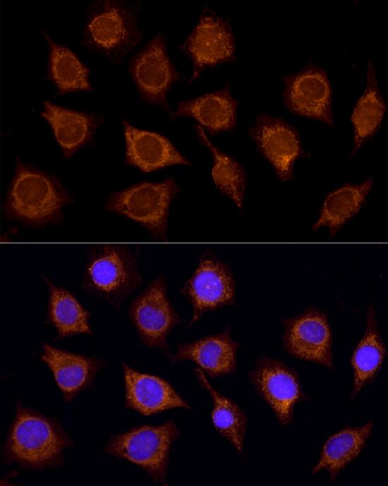 Immunocytochemistry/ Immunofluorescence: SUCLA2 Antibody - BSA Free [NBP2-94539] - Immunofluorescence analysis of L929 using SUCLA2 antibody (A10040) at dilution of  1:100 (40x lens). Blue: DAPI for nuclear staining.