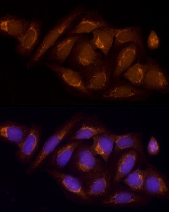 Immunocytochemistry/ Immunofluorescence: SUCLA2 Antibody - BSA Free [NBP2-94539] - Immunofluorescence analysis of U2OS using SUCLA2 antibody (A10040) at dilution of  1:100 (40x lens). Blue: DAPI for nuclear staining.