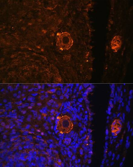 Immunocytochemistry/ Immunofluorescence: ZP3 Antibody - BSA Free [NBP2-94555] - Immunofluorescence analysis of rat oophoroma cells using ZP3 antibody (A8355) at dilution of 1:100. Blue: DAPI for nuclear staining.