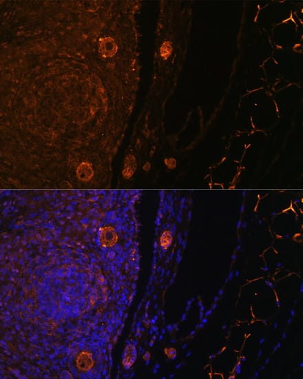 Immunocytochemistry/ Immunofluorescence: ZP3 Antibody - BSA Free [NBP2-94555] - Immunofluorescence analysis of rat oophoroma cells using ZP3 antibody (A8355) at dilution of 1:100. Blue: DAPI for nuclear staining.