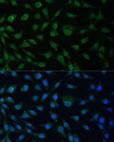 Immunocytochemistry/ Immunofluorescence: NUP214 Antibody - BSA Free [NBP2-94556] - Immunofluorescence analysis of L929 cells using NUP214 Rabbit pAb (A8357) at dilution of 1:100 (40x lens). Secondary antibody: Cy3 Goat Anti-Rabbit IgG (H+L) (AS007) at 1:500 dilution. Blue: DAPI for nuclear staining.