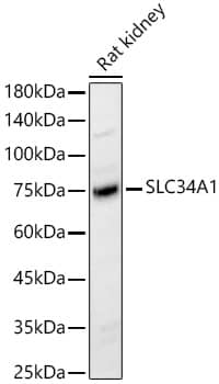 Western Blot: SLC34A1 Antibody - BSA Free [NBP2-94577] - Western blot analysis of Rat kidney, using SLC34A1 Rabbit pAb (A13635) at 1:2000 dilution.Secondary antibody: HRP Goat Anti-Rabbit IgG (H+L) (AS014) at 1:10000 dilution.Lysates/proteins: 25μg per lane.Blocking buffer: 3% nonfat dry milk in TBST.Detection: ECL Basic Kit (RM00020).Exposure time: 5s.