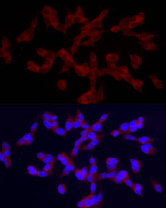 Immunocytochemistry/ Immunofluorescence: TRPC5 Antibody - Azide and BSA Free [TRPC5] - Immunofluorescence analysis of SH-SY5Y cells using TRPC5 Rabbit pAb  at dilution of 1:100 (40x lens). Secondary antibody: Cy3 Goat Anti-Rabbit IgG (H+L)  at 1:500 dilution. Blue: DAPI for nuclear staining.