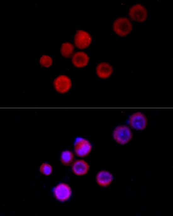 Immunocytochemistry/ Immunofluorescence: TRPC5 Antibody - Azide and BSA Free [TRPC5] - Immunofluorescence analysis of Neuro-2a cells using TRPC5 Rabbit pAb  at dilution of 1:100 (40x lens). Secondary antibody: Cy3 Goat Anti-Rabbit IgG (H+L)  at 1:500 dilution. Blue: DAPI for nuclear staining.