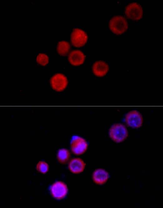 ICC/IF-NBP2-94585-TRPC5 Antibody-Analysis of Neuro-2a cells using TRPC5 Rabbit pAb at dilution of 1:100 (40x lens). Blue: DAPI for nuclear staining.