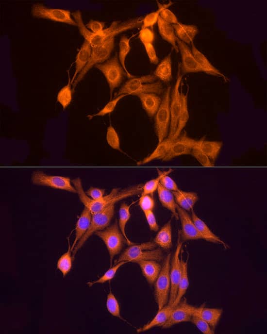 Immunocytochemistry/ Immunofluorescence: ULBP-2 Antibody - Azide and BSA Free [ULBP-2] - Immunofluorescence analysis of PC-12 cells using ULBP-2 Rabbit pAb  at dilution of 1:50 (40x lens). Secondary antibody: Cy3 Goat Anti-Rabbit IgG (H+L)  at 1:500 dilution. Blue: DAPI for nuclear staining.