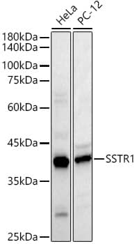 Western Blot: Somatostatin R1/SSTR1 Antibody - Azide and BSA Free [NBP2-94605] - Western blot analysis of extracts of various lysates, using Somatostatin R1/SSTR1 Rabbit pAb (A3134) at  1:400 dilution.Secondary antibody: HRP Goat Anti-Rabbit IgG (H+L) (AS014) at 1:10000 dilution.Lysates/proteins: 25μg per lane.Blocking buffer: 3% nonfat dry milk in TBST.Detection: ECL Basic Kit (RM00020).Exposure time: 90s.