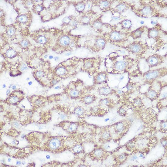 Immunohistochemistry: NDUFB7 Antibody - Azide and BSA Free [NDUFB7] - Immunohistochemistry analysis of paraffin-embedded human liver using NDUFB7 Rabbit pAb  at dilution of 1:200 (40x lens).Perform high pressure antigen retrieval with 10 mM citrate buffer pH 6.0 before commencing with IHC staining protocol.