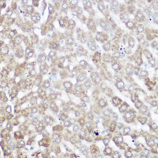 Immunohistochemistry: NDUFB7 Antibody - Azide and BSA Free [NDUFB7] - Immunohistochemistry analysis of paraffin-embedded mouse liver using NDUFB7 Rabbit pAb  at dilution of 1:200 (40x lens).Perform high pressure antigen retrieval with 10 mM citrate buffer pH 6.0 before commencing with IHC staining protocol.
