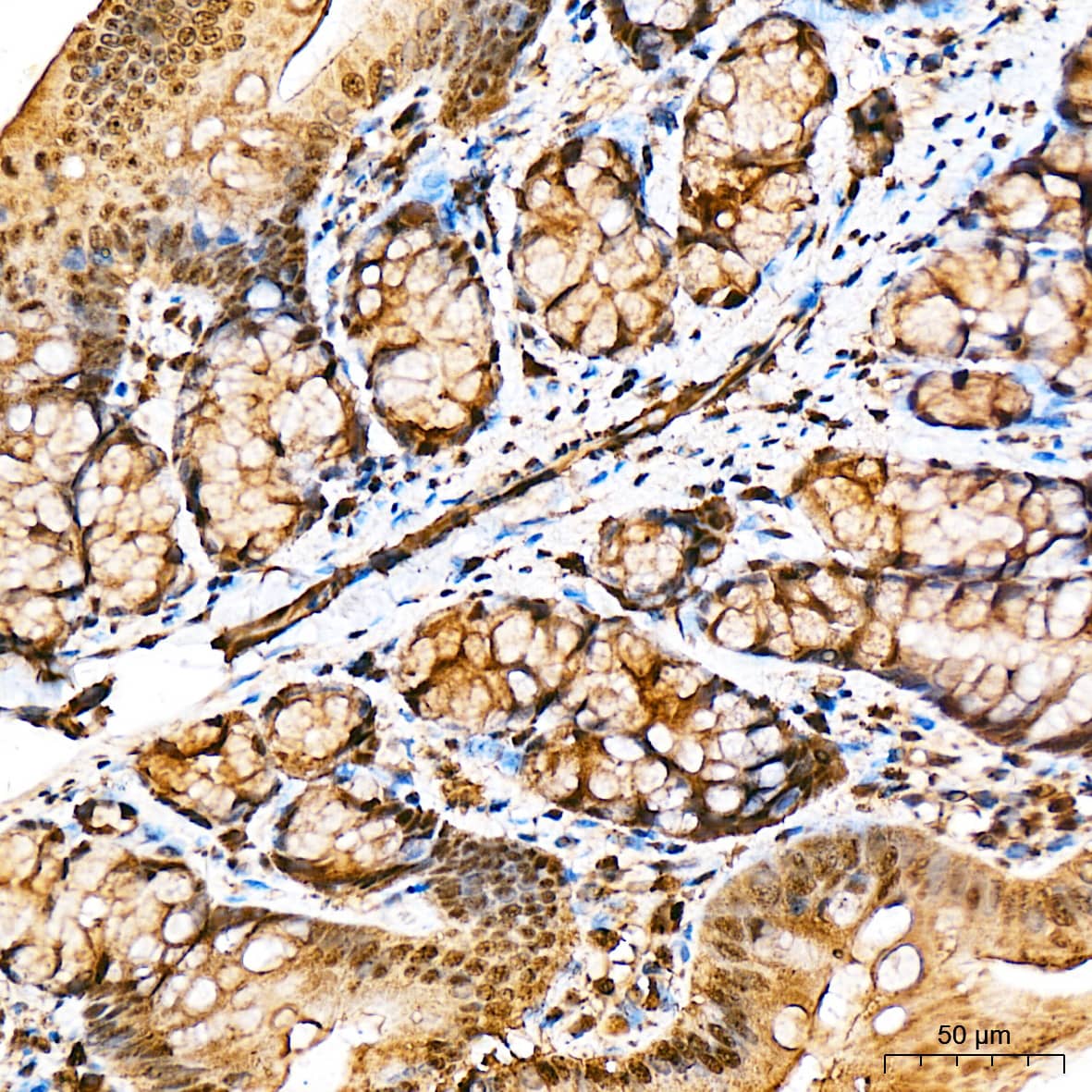 Immunohistochemistry Ubiquitin C Antibody - BSA Free