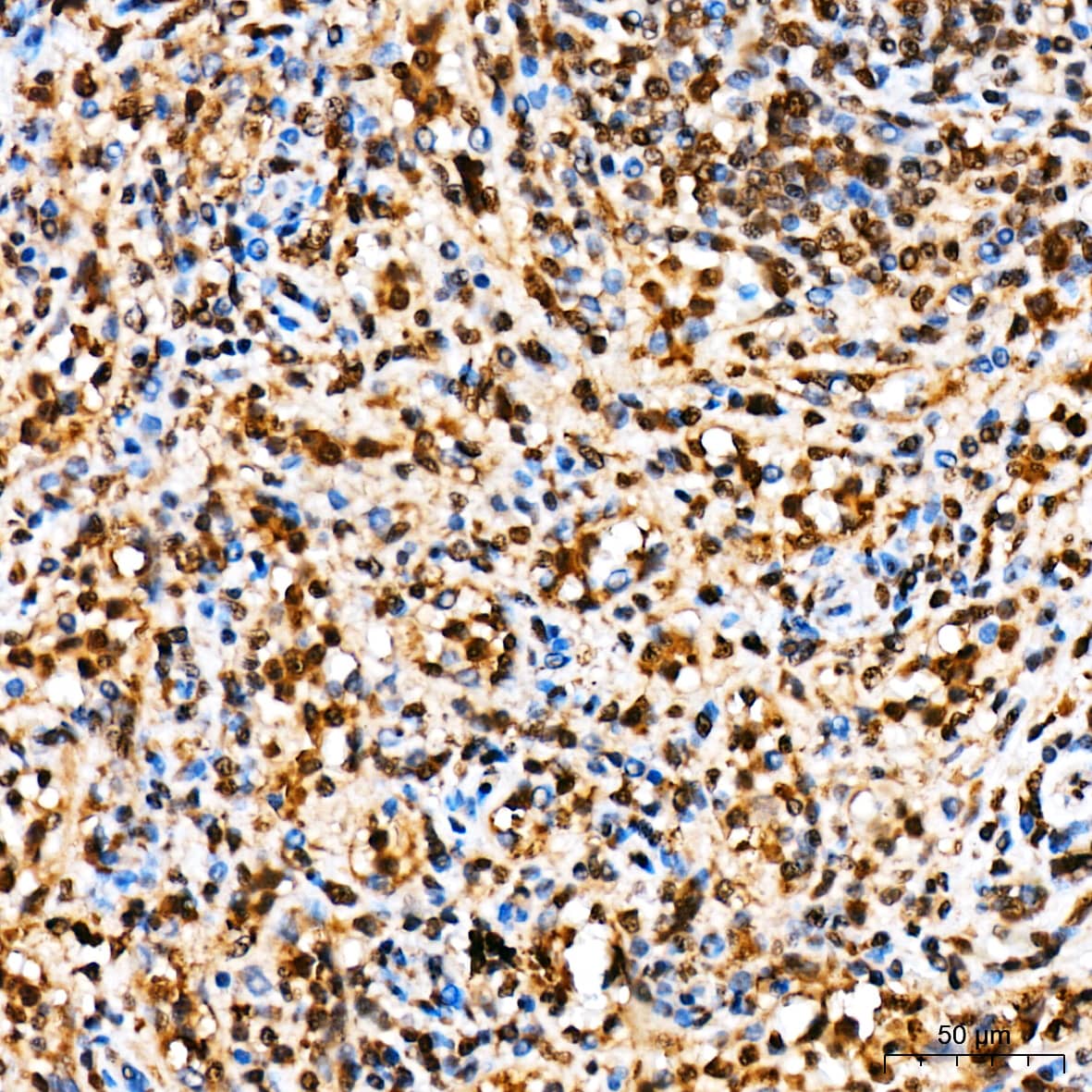 Immunohistochemistry Ubiquitin C Antibody - BSA Free