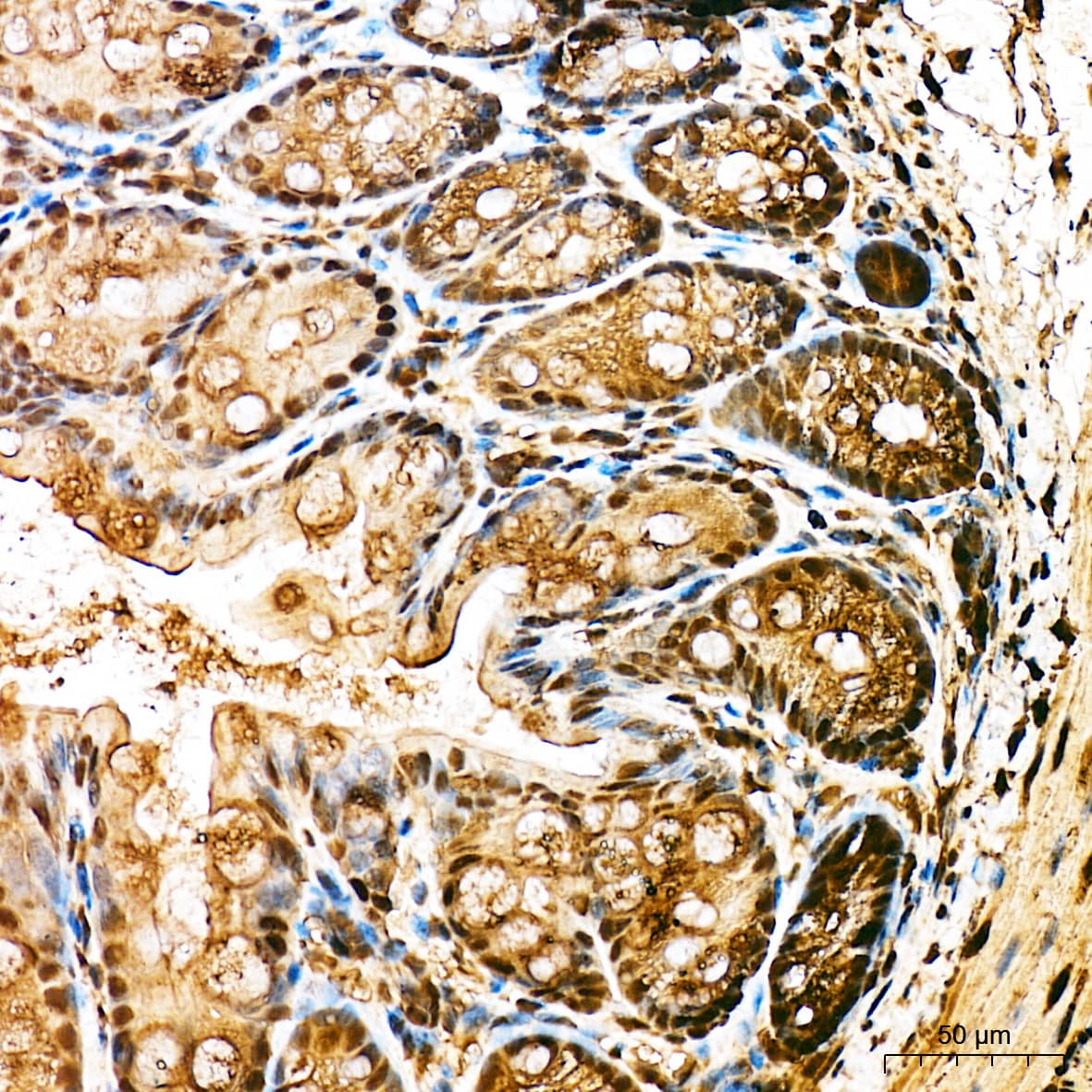 Immunohistochemistry: Ubiquitin C Antibody - BSA Free [NBP2-94633] - Immunohistochemistry analysis of Ubiquitin C in paraffin-embedded mouse large intestine tissue using Ubiquitin C Rabbit pAb (A3207) at a dilution of 1:100 (40x lens). High pressure antigen retrieval was performed with 0.01 M citrate buffer (pH 6.0) prior to IHC staining.