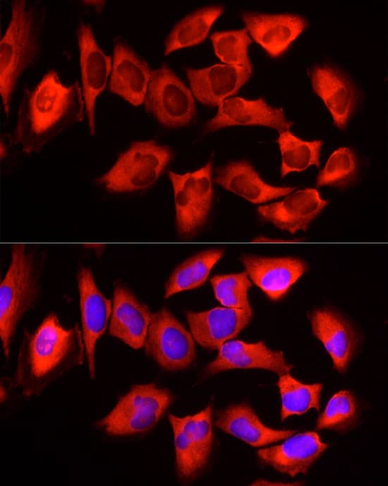 Immunocytochemistry/ Immunofluorescence: YTHDF3 Antibody - BSA Free [YTHDF3] - Immunofluorescence analysis of HeLa cells using YTHDF3 Rabbit pAb  at dilution of 1:50 (40x lens). Secondary antibody: Cy3 Goat Anti-Rabbit IgG (H+L)  at 1:500 dilution. Blue: DAPI for nuclear staining.