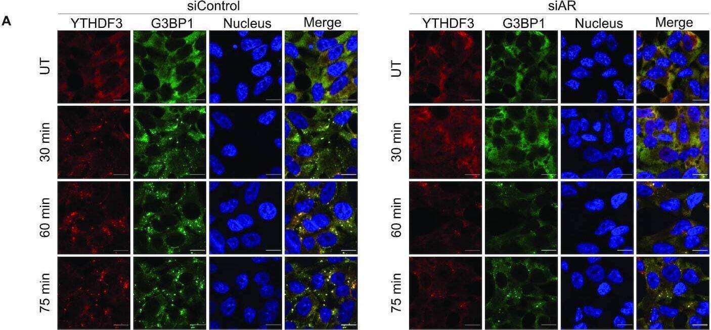 AR mRNA supports SG formation in response to ARPI stress treatment. (A) AR knockdown (KD) using siRNAs delayed the formation of SGs. LNCaP cells were transfected with siControl or siAR siRNAs, -/+ ARPI stress for different time points (30 min, 60 min and 75 min), and stained with anti-YTHDF3 and anti-G3BP1 antibodies to analyse SGs. Note that SG formation is significantly delayed at 30 and 60 min, while this effect is gradually lost at 75 min of treatment. (B) Quantification of SGs. (C) KD of AR did not affect the level of different SG proteins. (D) Treatment with AR degrader, ARD-61, did not affect the level of SGs in response to ARPI stress. (E) Quantification of SGs. ARD-61 treatment reduced the level of AR protein as revealed by Western blot (F) without affecting the level of AR mRNA as revealed by qRT-PCR (G). The results are an average of three independent experiments with **P < 0.01. n.s., non-significant. Scale 10 μm. Image collected and cropped by CiteAb from the following open publication (//pubmed.ncbi.nlm.nih.gov/34939643), licensed under a CC-BY license. Not internally tested by Novus Biologicals.