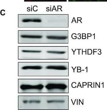 AR mRNA supports SG formation in response to ARPI stress treatment. (A) AR knockdown (KD) using siRNAs delayed the formation of SGs. LNCaP cells were transfected with siControl or siAR siRNAs, -/+ ARPI stress for different time points (30 min, 60 min and 75 min), and stained with anti-YTHDF3 and anti-G3BP1 antibodies to analyse SGs. Note that SG formation is significantly delayed at 30 and 60 min, while this effect is gradually lost at 75 min of treatment. (B) Quantification of SGs. (C) KD of AR did not affect the level of different SG proteins. (D) Treatment with AR degrader, ARD-61, did not affect the level of SGs in response to ARPI stress. (E) Quantification of SGs. ARD-61 treatment reduced the level of AR protein as revealed by Western blot (F) without affecting the level of AR mRNA as revealed by qRT-PCR (G). The results are an average of three independent experiments with **P < 0.01. n.s., non-significant. Scale 10 μm. Image collected and cropped by CiteAb from the following open publication (//pubmed.ncbi.nlm.nih.gov/34939643), licensed under a CC-BY license. Not internally tested by Novus Biologicals.