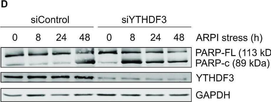 G3BP1 and YTHDF3 are cytoprotective proteins. (A) ARPI stress induced SG formation is reversible. LNCaP cells were unstressed, ARPI stressed or rescued from treatment. The cells were then stained with anti-G3BP1 and anti-YTHDF3 antibodies to reveal the SGs. Quantification of SGs is shown on the right-side panel. Note that ARPI stress- induced SG formation was reversed when treatment was withdrawn. (B) ARPI stress induced reduction in AR protein was restored to steady state level following stress removal. (C–F) KD of G3BP1 or YTHDF3 reduced cell survival in LNCaP cells. LNCaP cells transfected with siControl, siG3BP1 or siYTHDF3 were unstressed or treated with ARPI stress for 8, 24 and 48 h. The cell lysates were subjected to Western blotting for the indicated antibodies. Note that ARPI stress enhanced PARP cleavage in siG3BP1 (C) and siYTHDF3 (D) cells compared to control cells (8 h treatment). The above cells were subjected to IF using antibodies against activated BAX (2D2), an indicator of apoptosis (E). BAX positive cells are indicated by arrowheads. (F) Quantification of BAX activation. Note that acute ARPI stress strongly activated BAX in siG3BP1 and siYTHDF3 cells compared to control cells (8 h treatment). The results are an average of three independent experiments with ***P < 0.001. Scale 10 μm. Image collected and cropped by CiteAb from the following open publication (//pubmed.ncbi.nlm.nih.gov/34939643), licensed under a CC-BY license. Not internally tested by Novus Biologicals.