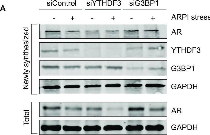 YTHDF3 translationally regulates AR mRNA. (A) Knockdown (KD) of G3BP1 did not affect rate of synthesis of AR protein, while KD of YTHDF3 reduced the rate of synthesis of AR protein as measured by Click chemistry (see Methods for details). (B) KD of YTHDF3 reduced the level of AR mRNA in the PSs. (C) KD of YTHDF3 did not affect the total mRNA level of AR. (D) YTHDF3 binds to AR mRNA in the PSs. (E) m6A-modified AR mRNA is reduced in the PSs after ARPI stress. Results are presented as an average of 3 independent experiments with ***P < 0.001, **P < 0.01, n.s., non-significant. (F) Model illustrating the regulation of AR mRNA during ARPI stress. Under the unstressed condition, AR mRNA is present as two fractions. m6A-modified translatable AR mRNA fraction, regulated by METTL3, is associated with YTHDF3 in the PSs, and m6A-unmodified untranslatable AR mRNA fraction is associated with G3BP1 in the non-PS fraction. When the cells are exposed to ARPI stress, PSs disassemble, and the m6A-modified AR mRNA and associated YTHDF3 is redistributed from the PSs to SGs to form the AR mRNA-YTHDF3 cluster. At the same time, G3BP1 associated m6A-unmodified AR mRNA also redistributes from the non-PS fraction to SGs to form the AR mRNA-G3BP1 cluster. Thus, these two ribonucleoprotein (RNP) clusters, AR mRNA-YTHDF3 and AR mRNA-G3BP1, co-exist in the SG. Image collected and cropped by CiteAb from the following open publication (//pubmed.ncbi.nlm.nih.gov/34939643), licensed under a CC-BY license. Not internally tested by Novus Biologicals.