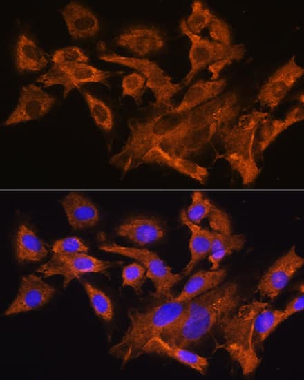 Immunocytochemistry/ Immunofluorescence: V1a Vasopressin R/AVPR1A Antibody - BSA Free [NBP2-94637] - Immunofluorescence analysis of C6 cells using V1a Vasopressin R/AVPR1A Rabbit pAb (A8400) at dilution of 1:100. Blue: DAPI for nuclear staining.