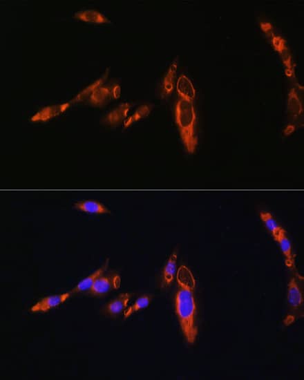 Immunocytochemistry/ Immunofluorescence: V1a Vasopressin R/AVPR1A Antibody - BSA Free [NBP2-94637] - Immunofluorescence analysis of NIH/3T3 cells using V1a Vasopressin R/AVPR1A Rabbit pAb (A8400) at dilution of 1:100. Blue: DAPI for nuclear staining.