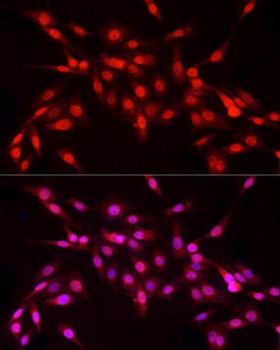 Immunocytochemistry/ Immunofluorescence: NFIA Antibody - BSA Free [NFIA] - Immunofluorescence analysis of PC-12 cells using NFIA Rabbit pAb  at dilution of 1:100 (40x lens). Secondary antibody: Cy3 Goat Anti-Rabbit IgG (H+L)  at 1:500 dilution. Blue: DAPI for nuclear staining.