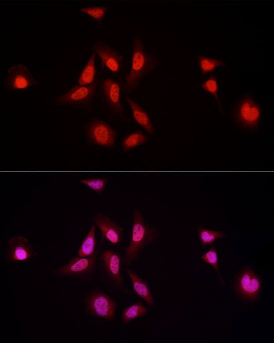 Immunocytochemistry/ Immunofluorescence: NFIA Antibody - BSA Free [NFIA] - Immunofluorescence analysis of HeLa cells using NFIA Rabbit pAb  at dilution of 1:100 (40x lens). Secondary antibody: Cy3 Goat Anti-Rabbit IgG (H+L)  at 1:500 dilution. Blue: DAPI for nuclear staining.