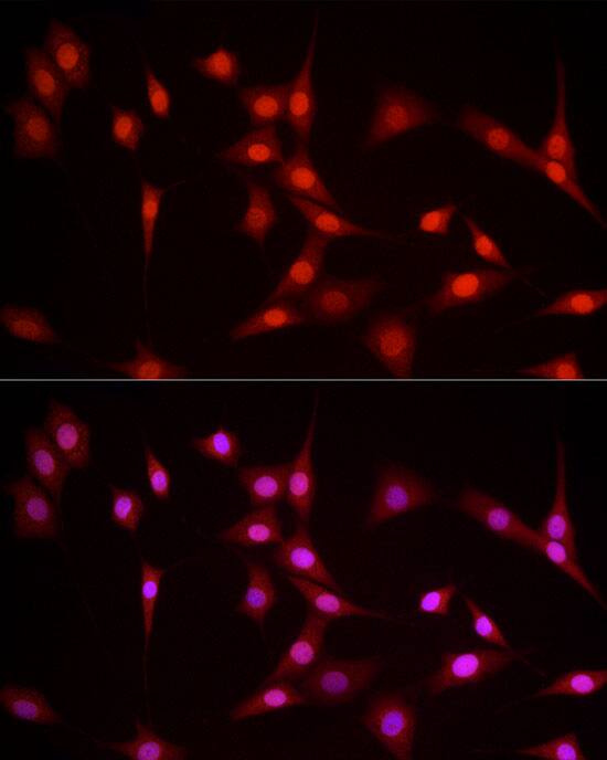 Immunocytochemistry/ Immunofluorescence: NFIA Antibody - BSA Free [NFIA] - Immunofluorescence analysis of NIH/3T3 cells using NFIA Rabbit pAb  at dilution of 1:100 (40x lens). Secondary antibody: Cy3 Goat Anti-Rabbit IgG (H+L)  at 1:500 dilution. Blue: DAPI for nuclear staining.