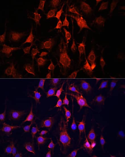 Immunocytochemistry/ Immunofluorescence: UCP3 Antibody - Azide and BSA Free [UCP3] - Immunofluorescence analysis of C6 cells using UCP3 Rabbit pAb  at dilution of 1:100. Secondary antibody: Cy3-conjugated Goat anti-Rabbit IgG (H+L)  at 1:500 dilution. Blue: DAPI for nuclear staining.