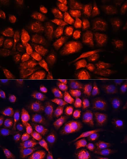 Immunocytochemistry/ Immunofluorescence: UCP3 Antibody - Azide and BSA Free [UCP3] - Immunofluorescence analysis of HeLa cells using UCP3 Rabbit pAb  at dilution of 1:100. Secondary antibody: Cy3-conjugated Goat anti-Rabbit IgG (H+L)  at 1:500 dilution. Blue: DAPI for nuclear staining.