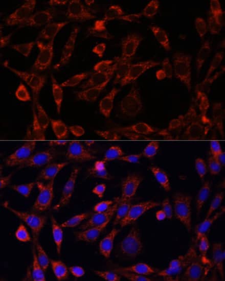 Immunocytochemistry/ Immunofluorescence: UCP3 Antibody - Azide and BSA Free [UCP3] - Immunofluorescence analysis of NIH/3T3 cells using UCP3 Rabbit pAb  at dilution of 1:100. Secondary antibody: Cy3-conjugated Goat anti-Rabbit IgG (H+L)  at 1:500 dilution. Blue: DAPI for nuclear staining.