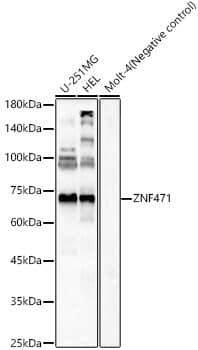 Western Blot: ZNF471 Antibody - Azide and BSA Free [ZNF471] - Western blot analysis of various lysates, using ZNF471 Rabbit pAb  at 1:2500 dilution.Secondary antibody: HRP-conjugated Goat anti-Rabbit IgG (H+L)  at 1:10000 dilution.Lysates/proteins: 25ug per lane.Blocking buffer: 3% nonfat dry milk in TBST.Detection: ECL Basic Kit .Exposure time: 60s.