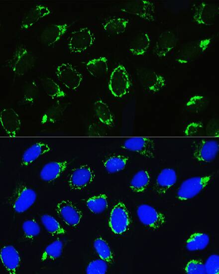 Immunocytochemistry/ Immunofluorescence: PTCD3 Antibody - BSA Free [NBP2-94697] - Immunofluorescence analysis of U2OS cells using PTCD3 Rabbit pAb (A8497) at dilution of 1:100. Blue: DAPI for nuclear staining.