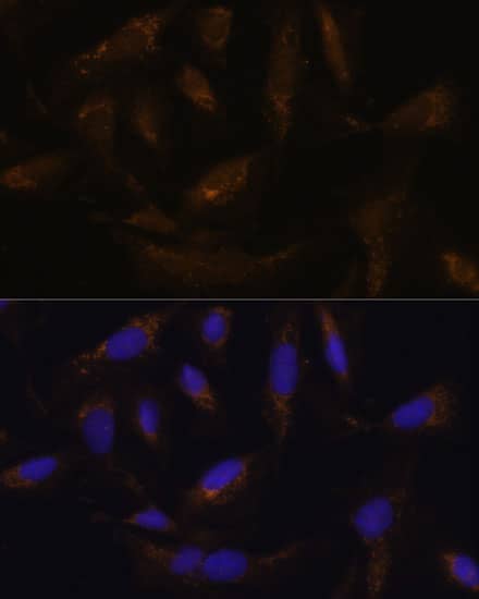 Immunocytochemistry/ Immunofluorescence: UCP4 Antibody - Azide and BSA Free [UCP4] - Immunofluorescence analysis of U-2 OS cells using UCP4 Rabbit pAb  at dilution of 1:100. Secondary antibody: Cy3-conjugated Goat anti-Rabbit IgG (H+L)  at 1:500 dilution. Blue: DAPI for nuclear staining.