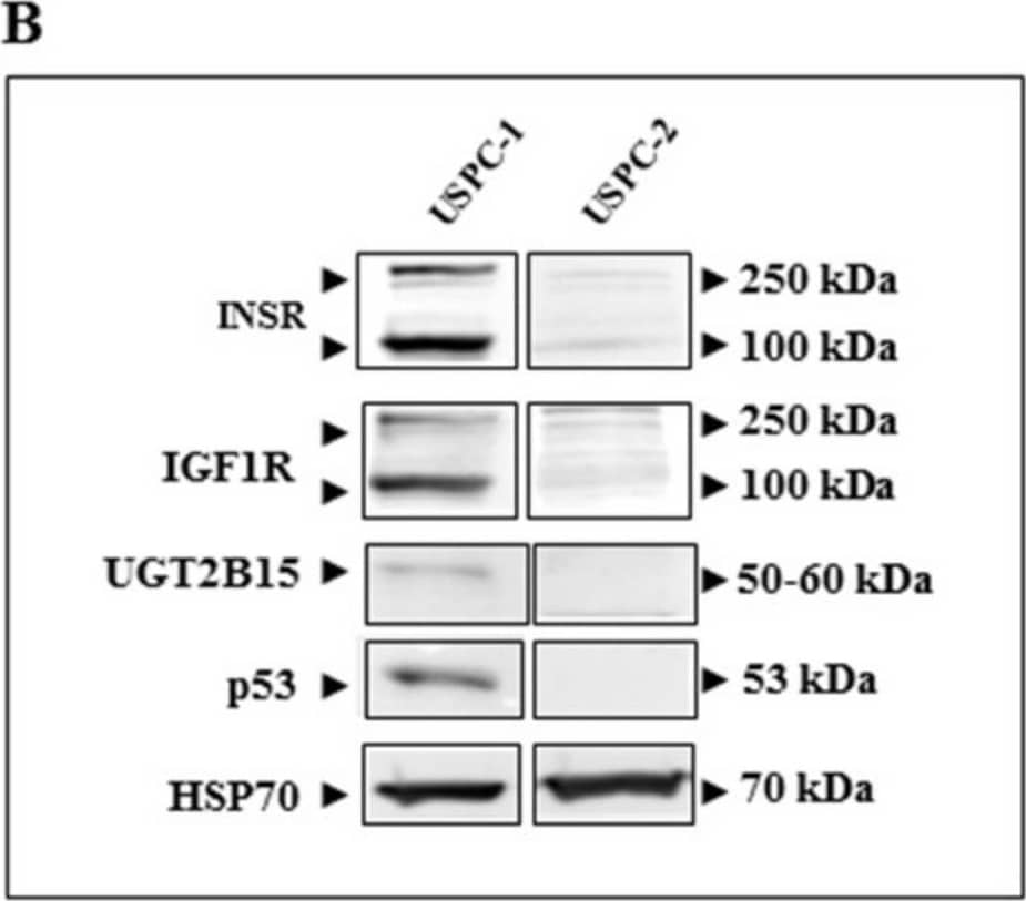 Expression of UGT2B15 in endometrial cancer cell lines. (A) Total RNA was obtained from confluent USPC-1 and USPC-2 endometrial cancer cell lines and UGT2B15 mRNA levels were measured by RT-QPCR. A value of 1 was assigned to the UGT2B15 mRNA levels in USPC-1 cells. * p < 0.01 vs. USPC-1 cells. (B) Total protein was obtained from confluent USPC-1 and USPC-2 cell lines and UGT2B15, IGF1R, INSR, and p53 protein levels were measured by Western blots. HSP70 levels were assessed as a loading control. Image collected and cropped by CiteAb from the following open publication (//pubmed.ncbi.nlm.nih.gov/35626664), licensed under a CC-BY license. Not internally tested by Novus Biologicals.