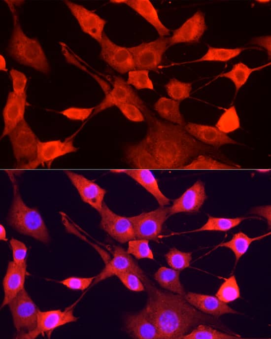 Immunocytochemistry/ Immunofluorescence: ULK1 Antibody - Azide and BSA Free [NBP2-94753] - Immunofluorescence analysis of NIH/3T3 cells using ULK1 Rabbit pAb (A8529) at dilution of 1:200 (40x lens). Secondary antibody: Cy3 Goat Anti-Rabbit IgG (H+L) (AS007) at 1:500 dilution. Blue: DAPI for nuclear staining.