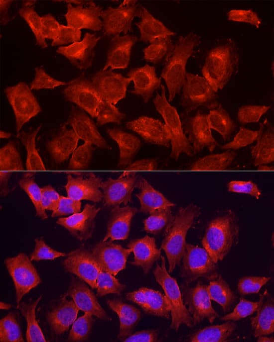 Immunocytochemistry/ Immunofluorescence: ULK1 Antibody - Azide and BSA Free [NBP2-94753] - Immunofluorescence analysis of HeLa cells using ULK1 Rabbit pAb (A8529) at dilution of 1:200 (40x lens). Secondary antibody: Cy3 Goat Anti-Rabbit IgG (H+L) (AS007) at 1:500 dilution. Blue: DAPI for nuclear staining.