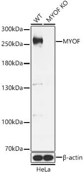 Western Blot: Myoferlin Antibody - Azide and BSA Free [NBP2-94759] - Western blot analysis of lysates from wild type(WT) and Myoferlin knockout (KO) HeLa(KO) cells, using [KO Validated] Myoferlin Rabbit pAb (A15427) at 1:1000 dilution.Secondary antibody: HRP Goat Anti-Rabbit IgG (H+L) (AS014) at 1:10000 dilution.Lysates/proteins: 25μg per lane.Blocking buffer: 3% nonfat dry milk in TBST.Detection: ECL Basic Kit (RM00020).Exposure time: 1s.