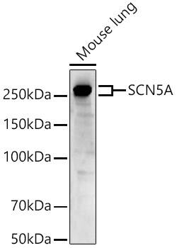 Western Blot: Nav1.5 Antibody - Azide and BSA Free [Nav1.5] - Western blot analysis of lysates from Mouse lung, using Nav1.5 Rabbit pAb  at  1:1000 dilution.Secondary antibody: HRP-conjugated Goat anti-Rabbit IgG (H+L)  at 1:10000 dilution.Lysates/proteins: 25ug per lane.Blocking buffer: 3% nonfat dry milk in TBST.Detection: ECL Basic Kit .Exposure time: 40s.