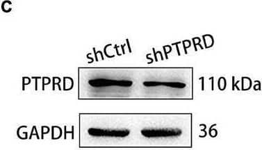 Protein tyrosine phosphatase receptor type D knockdown attenuates neuropathic pain following CCI. (A) Representative images of GFP (green) and NeuN staining (red) 14 days after shPTPRD injection in the DRG. Scale bar, 100 μm. (B) qRT-PCR analysis of the relative expression of PTPRD in DRGs transfected with shCtrl or shPTPRD after CCI. N = 3, ***p < 0.001. (C) Western blot of PTPRD in DRG tissues transfected with shCtrl or shPTPRD after CCI. Each experiment was repeated three times. (D) Quantitative analysis of data in (C). GAPDH served as the loading control. N = 3, ***p < 0.001. (E) Schedule of lentivirus administration, surgery, and behavioral testing. (F–H) Paw withdrawal threshold, paw withdrawal latency, and paw withdrawal frequency prior to virus injection (BL), on the day of surgery, or 1, 3, 5, 7, 14, and 21 days after CCI. N = 6 mice per group. CCI + shPTPRD vs. CCI + shCtrl, *p < 0.05, **p < 0.01, ***p < 0.001. CCI vs. sham, #p < 0.05, ##p < 0.01, ###p < 0.001. Statistical comparisons were performed using unpaired Student’s t-test (B,D) or two-way ANOVA with Tukey’s post hoc test (F–H). Image collected and cropped by CiteAb from the following open publication (//pubmed.ncbi.nlm.nih.gov/35493326), licensed under a CC-BY license. Not internally tested by Novus Biologicals.