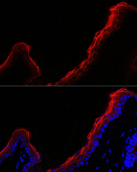 Immunocytochemistry/ Immunofluorescence: Periplakin Antibody - BSA Free [NBP2-94787] - Immunofluorescence analysis of mouse skin cells using Periplakin Rabbit pAb (A14051) at dilution of 1:500 (40x lens). Blue: DAPI for nuclear staining.